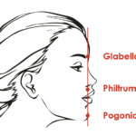 Schéma des zone G Sn et Pog du visage