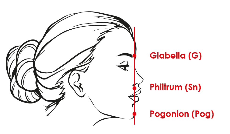 Schéma des zone G Sn et Pog du visage